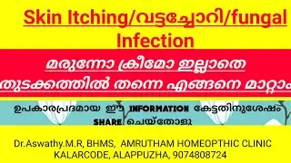 #ചോറിച്ചിൽ #skinAllergy ##SkinItching #വട്ടച്ചോറി #fungallnfection
