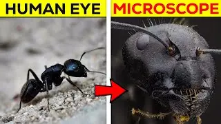 How These Things Look Under A Microscope 😱