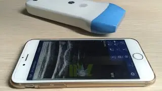 Ultrasound Scan linear Probe MSLPU41 for Iphone / Ipad / Android video