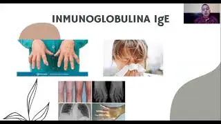 Inmunoglobulinas