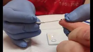 Diagn&oacute;stico de infecci&oacute;n por VIH: Algoritmo CDC-APHL