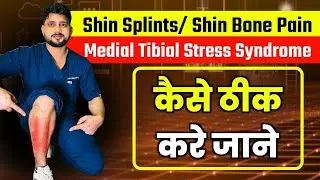 Dr.PC Live-How To Fix Shin Splint Pain Fast (8 Best Stretches & Exercises For MTSS