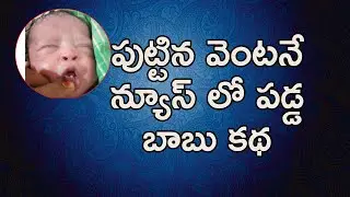child born with publicity || real story || Anchor pavan |