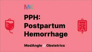 Postpartum Hemorrhage - Definition, types, risk factors, causes and management