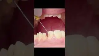 The pulp is the heart of the tooth