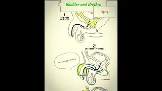 Injury to Bladder and Urethra
