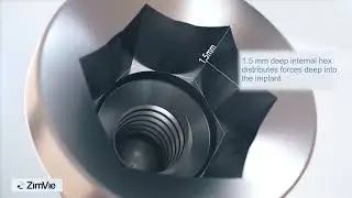 ZimVie - TSV implant final