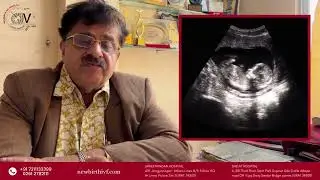 What is a birth defect?Birth defect diagnosis, Symptoms, Treatment Abnormal Child Awareness in Surat