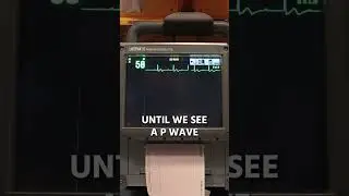 The KEY To HEART BLOCKS