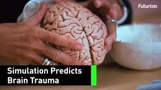 Stanford's Simulation Is The Guide For Future Brain Surgeries