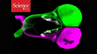 Ancient fish share a key feature of human vision