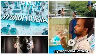 Water-Induced Loss of Body Control: know it's causes & Management options