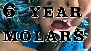 6 Year Molars