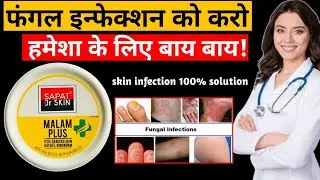 SAPAT DR SKIN MALAM REVIEW IN HINDI | USES, SIDE EFFECTS |