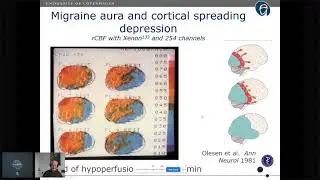 Prof Jes Olesen - 40 years of headache research