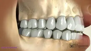 Canine Guidance Explained | How Your Bite Protects Your Teeth