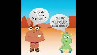 Ask Eczii about Kids Psoriasis - AproDerm