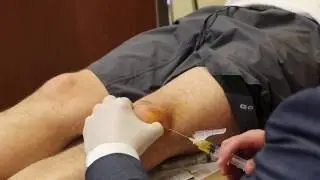 Stem Cell Therapy - Patient Story