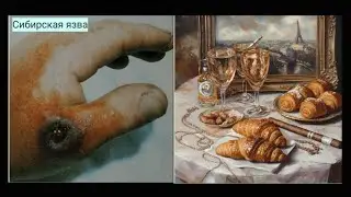 Сибирская язва. Туляремия. Чума