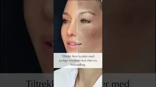 🌸 Fra livl&oslash;s- til str&aring;lende hud, f&aring; frem en strammere og vakker hudtone med C35 🌸