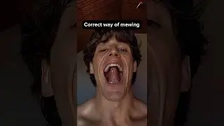 Correct Way Of Mewing | Mewing Exercise