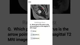 🩺MRI Quiz: Uterus Anatomy!🤔
