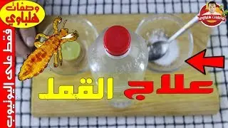 أسهل طريقة للتخلص من قمل الرأس خاصة لدى أطفال المدارس طريقة آمنة ومضمونة ونتائجها سريعة