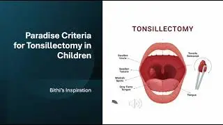 When can surgically tonsils be removed 🪼🫧🩵#tonsilsurgery #tonsilitis 