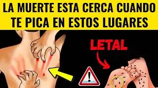 &iexcl;NO IGNORES ESTA ZONA DE PICAZ&Oacute;N COM&Uacute;N DESPU&Eacute;S DE LOS 60!