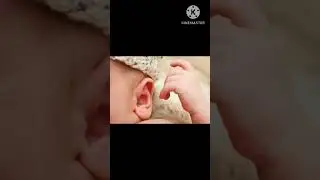 Baby rashes behind the ear. #shorts #ytshorts #trendingshorts #babyrashes #tips#hindi #babycare #ear