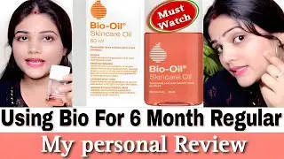 Bio oil Review after using 6 month| is it really work on strech mark or Scar? skincare oil