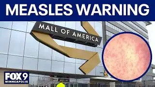 If you visited the Mall of America on May 24, watch out for measles symptoms