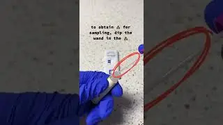 Fecal Occult Blood Test: How it&rsquo;s done 💩
