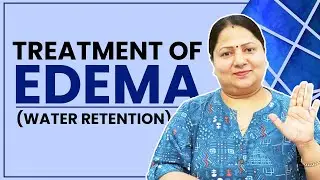 Treatment of Edema (Water Retention) || सूजन (एडिमा) का इलाज by Acupressure