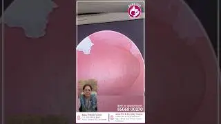 What is Hysteroscopy? | Explained by Dr. Astha Chakravarty - Sr. IVF Consultant