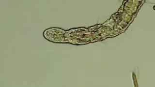 Aeolosoma