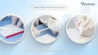 Glass Ionomer Cement