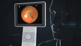 Horus+ DEC200 Digital 5MP eye fundus camera │ MiiS