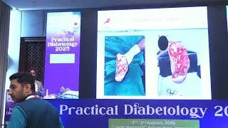 Workshop: New Treatment Modalities in Diabetic Foot Care | Practical Diabetology 2025