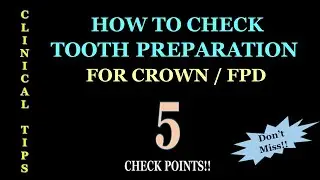 CHECK POINTS FOR TOOTH PREPARATION FOR CROWN & FPD / How to check ?