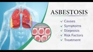 Understanding Asbestosis: Symptoms, Causes, and Management #shorts #youtubeshorts