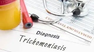 Treatment options or Therapy for trichomoniasis