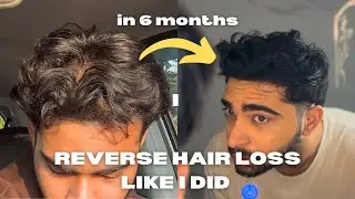 How to stop Hair loss & Regrow your hair in 6 Months