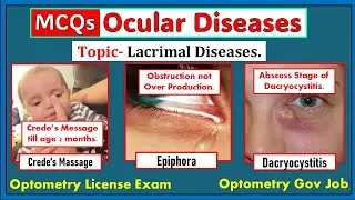 Lacrimal Apparatus MCQs for Optometry Exams | Gov Job- AIIMS RRB PSC | License Exams- DHA HAAD MOH