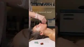 Buccal {intraoral} facial