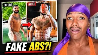 Did Drake Get Ab Surgery?
