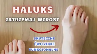 Haluksy - zatrzymaj wzrost i BÓL. FizjoKris