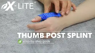 X-Lite&reg; Thumb Post Splint Guide #handtherapy