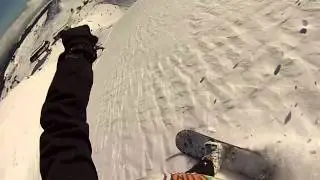 Slide & Slash Around Implant