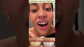 Hismile toothpaste | White teeth and long-lasting fresh breath 4
